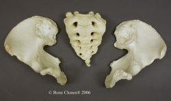 Pelvis, disarticulated, Human adult male 