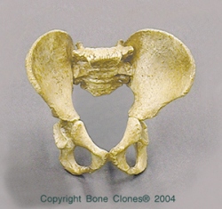 5-yr old Child, Archaic Pelvis