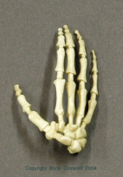 Hand-Skelett 5-jähriges Kind, 8000 Jahre alt