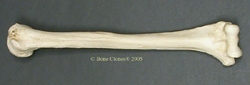 Humerus left, Human Female African-American