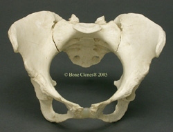 Pelvis, Human Female African-American