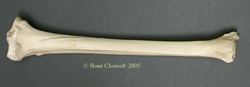 Tibia, Left, Human Female African-American