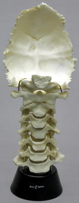 Human Cervical Vertebrae and Occipital Assembly