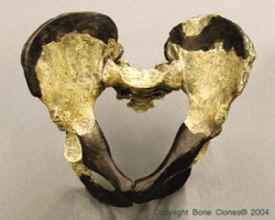 Homo ergaster Pelvis- KNM-WT-15000