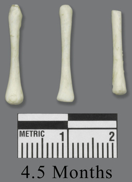 Human Fetal 4 1/2 Months Set of 3 Postcranial Bones