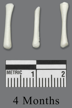 Human Fetal 4 Months Set of 3 Postcranial Bones