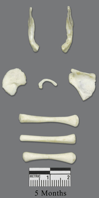 Human Fetal 5 Months Set of 8 Postcranial Bones