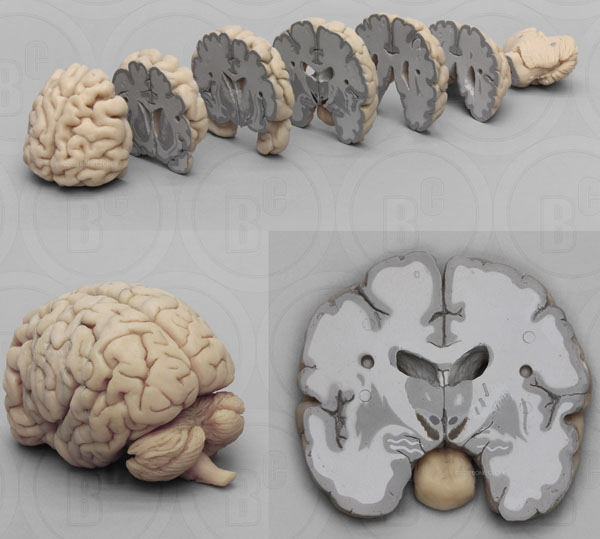 Human Brain Multiple Coronal Sections