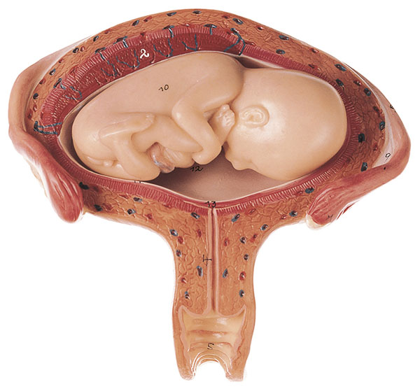 Uterus mit Fetus im 4. bis 5. Monat