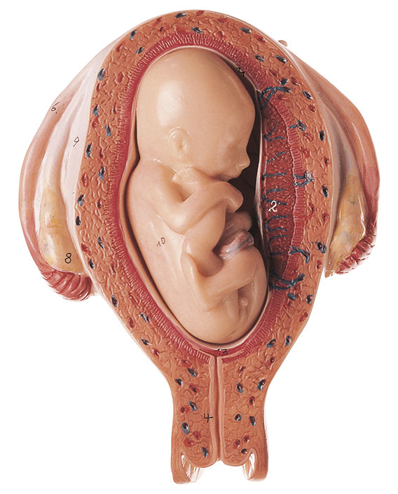 Uterus mit Fetus im 5. Monat