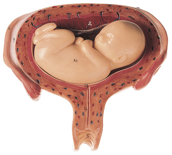 Uterus mit Fetus im 5. Monat