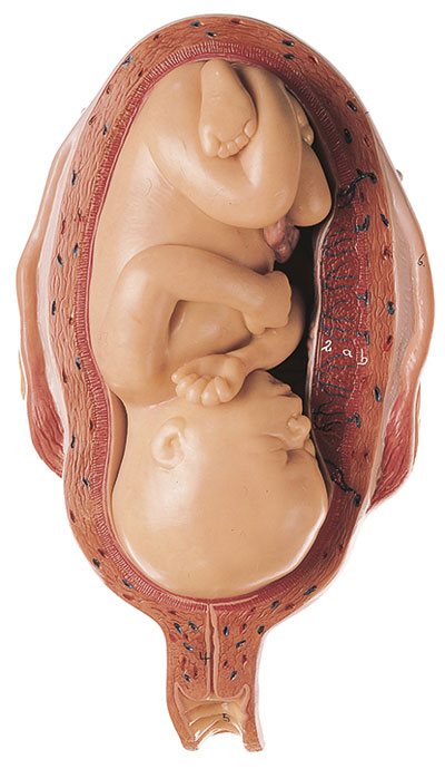 Uterus mit Fetus im 7. Monat