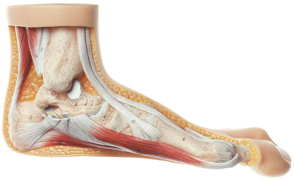 Hallux Valgus