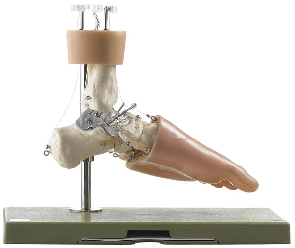 Funktionsmodell der Fußwurzel