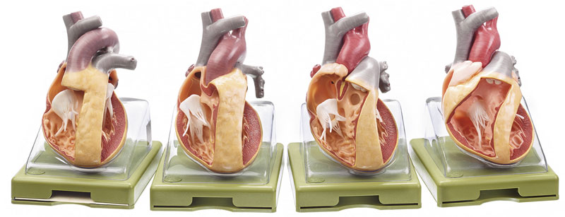 Series of Models representing Congenital Organic Heart Defects