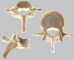 Vertebra