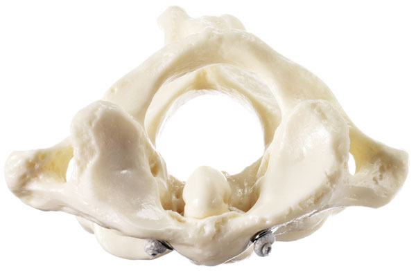 First and Second Cervical Vertebrae