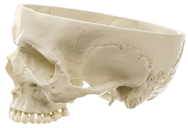 Base of skull