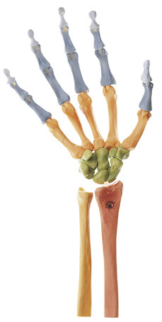 Hand-Skelett, rechts