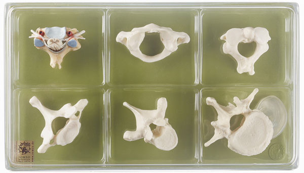 Case with Collection “Vertebrae and Spinal Cord”