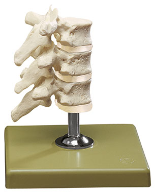 Three Thoracic Vertebrae with Discs