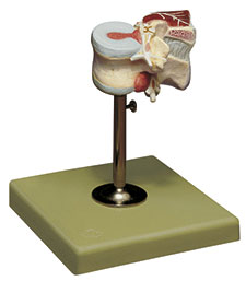 First Lumbar Vertebra with Intervertebral Discs and Dorsal Muscles