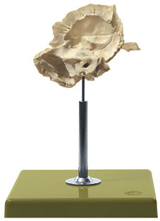 Artificial Temporal Bone