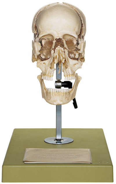 Artificial Bauchene Skull of an Adult