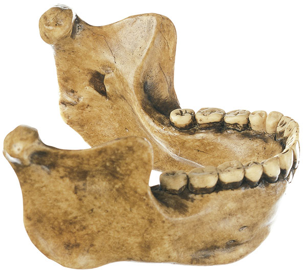 Lower Jaw from Mauer near Heidelberg, Homo heidelbergensis