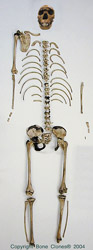 Homo ergaster Skeleton- KNM-WT-15000-Nariokotome boy , disarticulated
