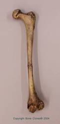 Homo ergaster Femur- KNM-WT-15000