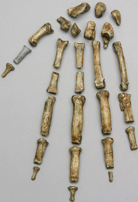 Ardipithecus ramidus Hand, disarticulated