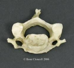 Vertebra, cervical, single, Human adult male