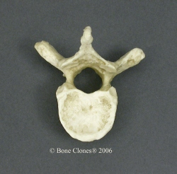 Vertebra, thoracic single, Human adult male