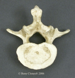 Vertebra, lumbar single, Human adult male