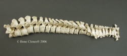 Human Male Asian Vertebral Column-all 24 Vertebrae, Disarticulated