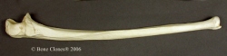 Ulna, Human adult male 