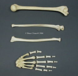 Human Male Asian Arm, Disarticulated without Scapula