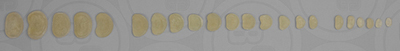 Set of 23 Vertebral Discs, Human adult male