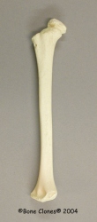 Humerus, Human 5-year-old Archaic Child