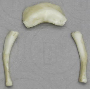 Hyoid (3) pcs., Human 14-16-month-old Child