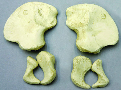 Pelvis (6) pcs., Human 14-16-month-old Child