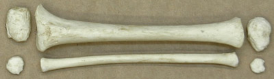 Tibia & Fibula and epiphyses (5) (R or L), Human 14-16-month-old Child