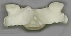 Vertebra, cervical, single, Human adult female