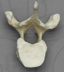 Vertebra, thoracic single, Human adult female