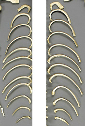Ribs, Set of 24 (left and right), Human adult female