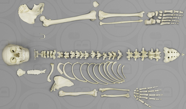 Female Human Half Skeleton, Asian, Disarticulated calvarium-cut skull 