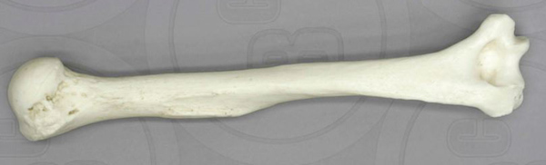 Humerus, Human adult female